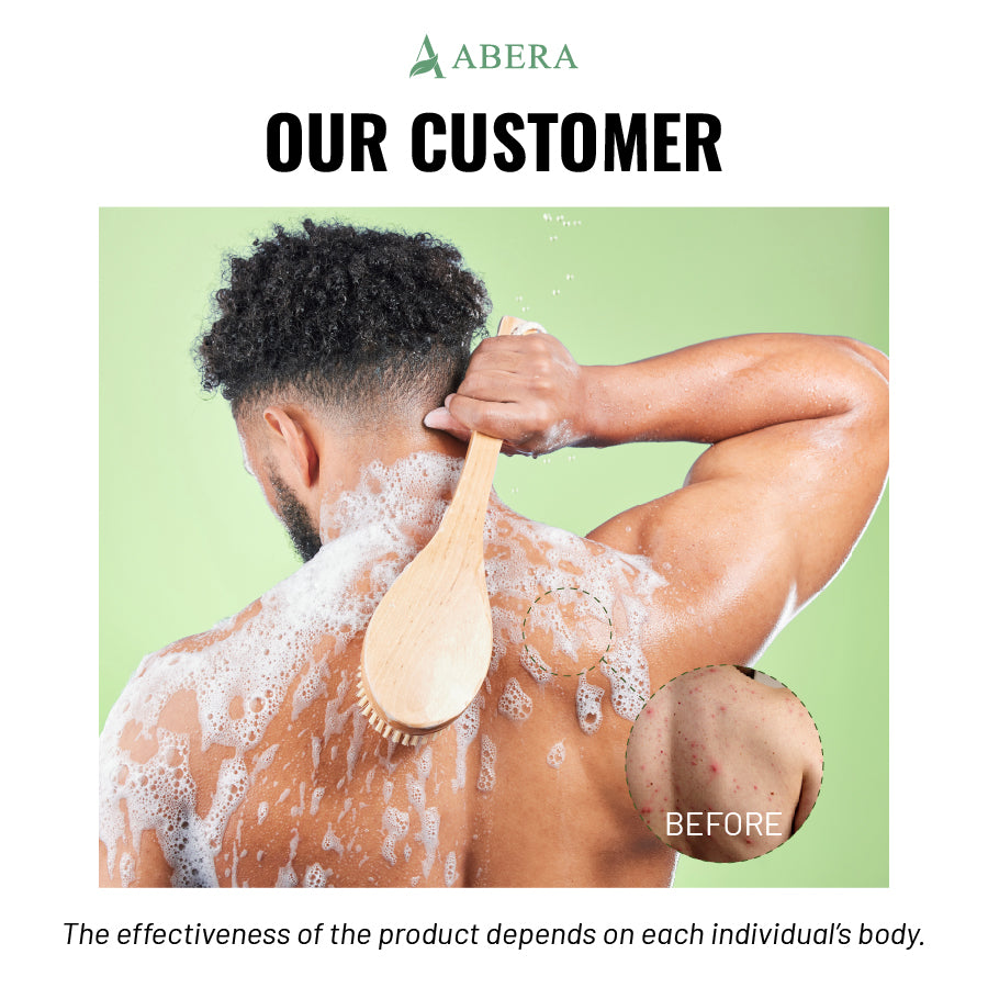 ABERA High-Performance Folliculitis Body Wash