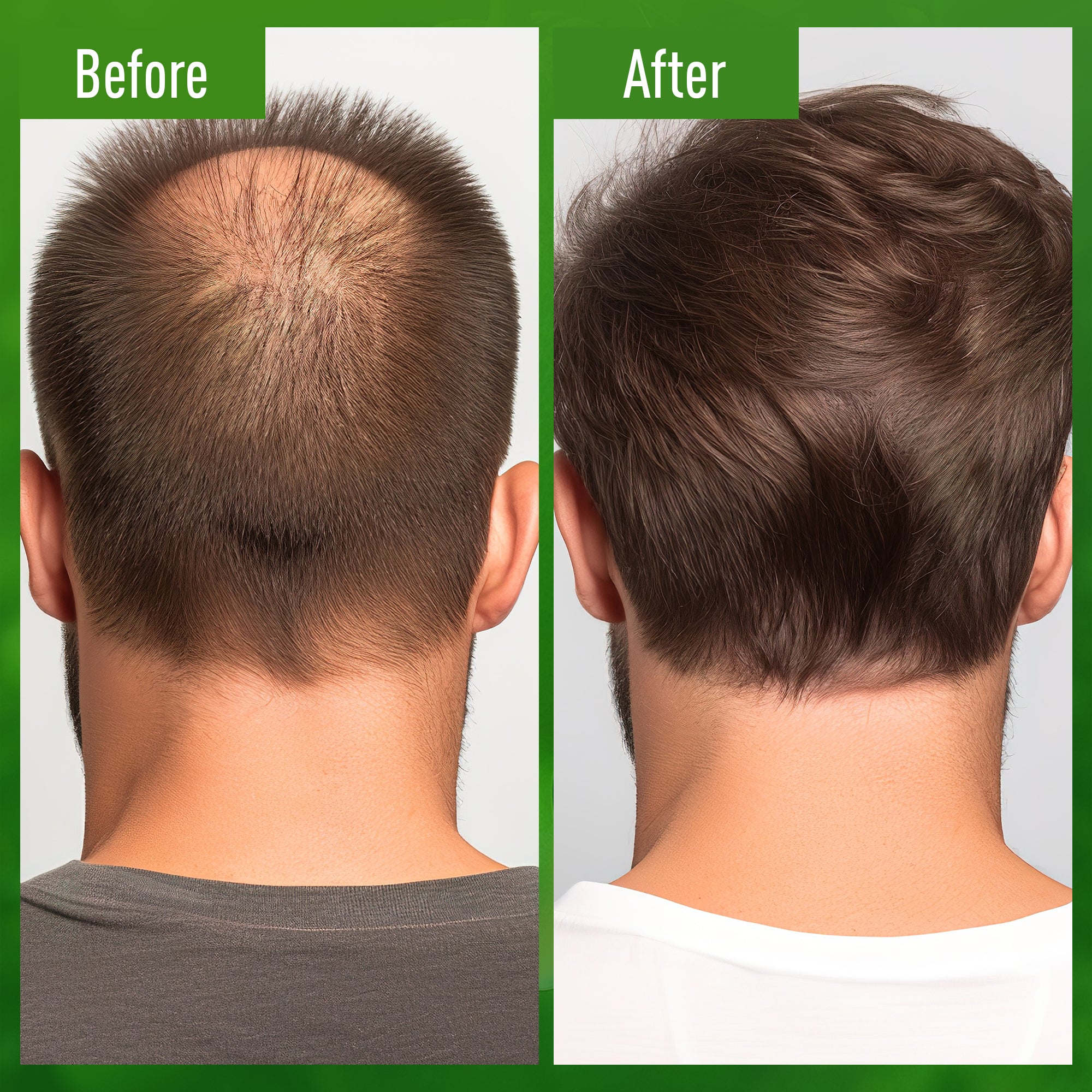 ABERA Advanced Hair Growth Serum With Grapefruit Essence